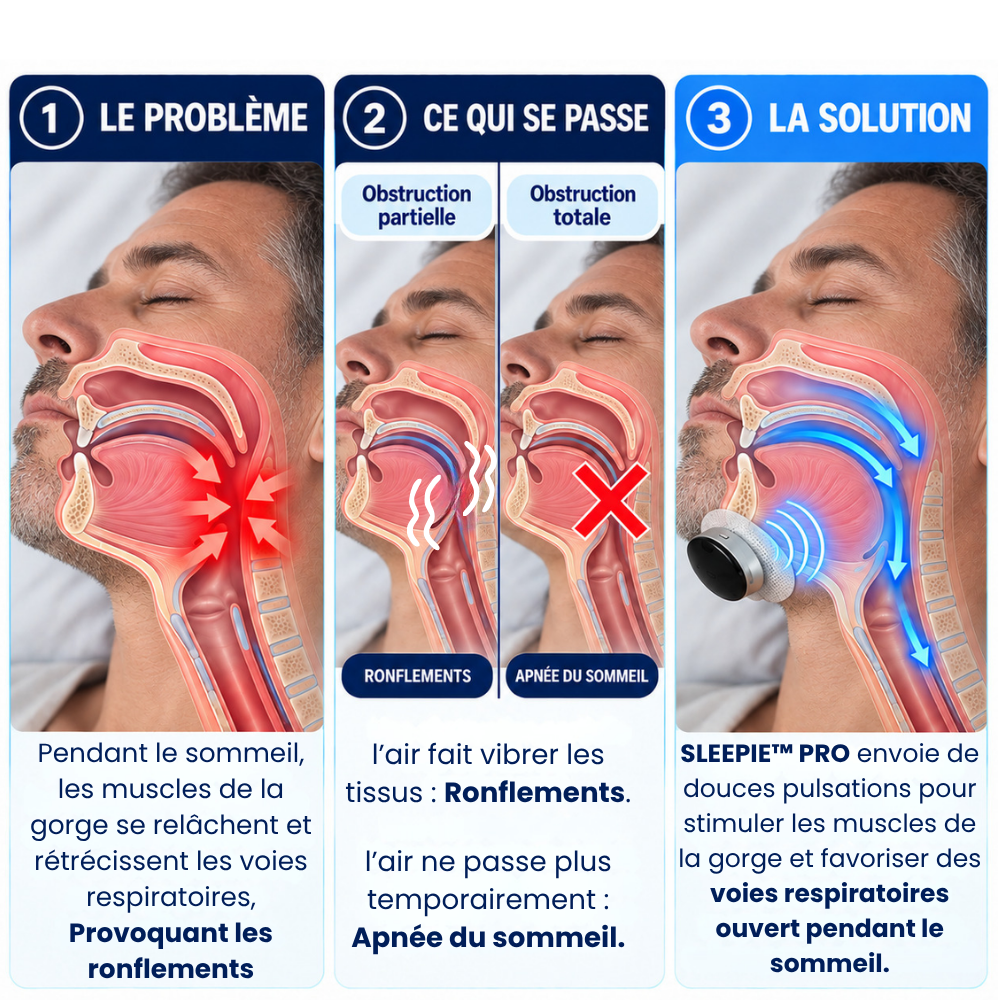 SLEEPIE™ PRO — Dispositif anti-ronflement